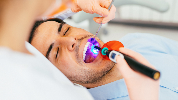 dental sealants in ponte vedra beach