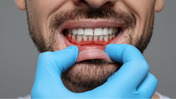 periodontal treatment in ponte vedra beach