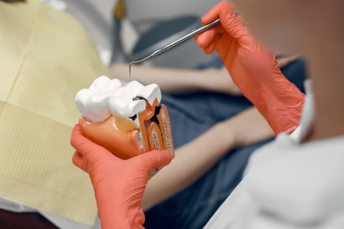 root-canal-treatment-for-a-badly-infected-tooth